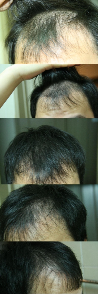 hair.JPG
