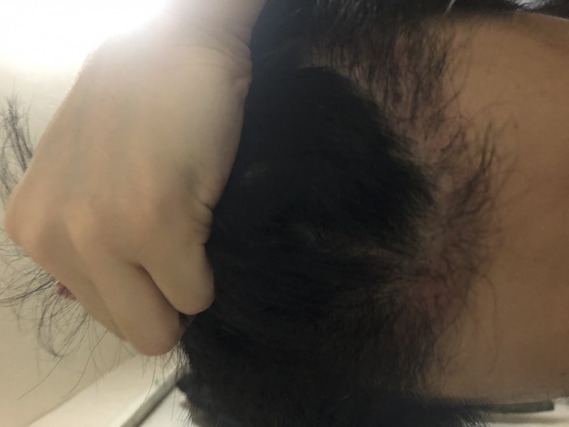 정면
