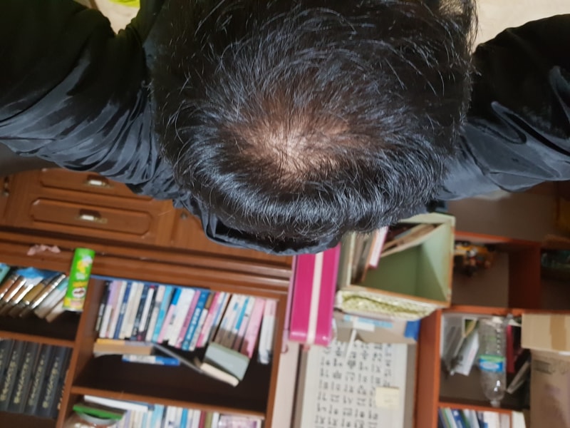 15440128560975817604635674894845.jpg