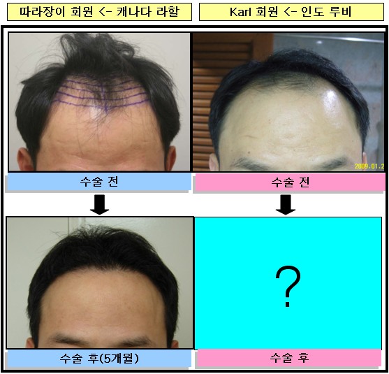 수술후기.jpg