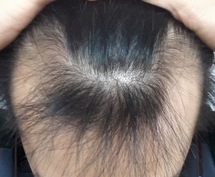 사본 -20151125_220502.jpg