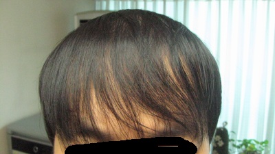 앞-내렸을때.jpg
