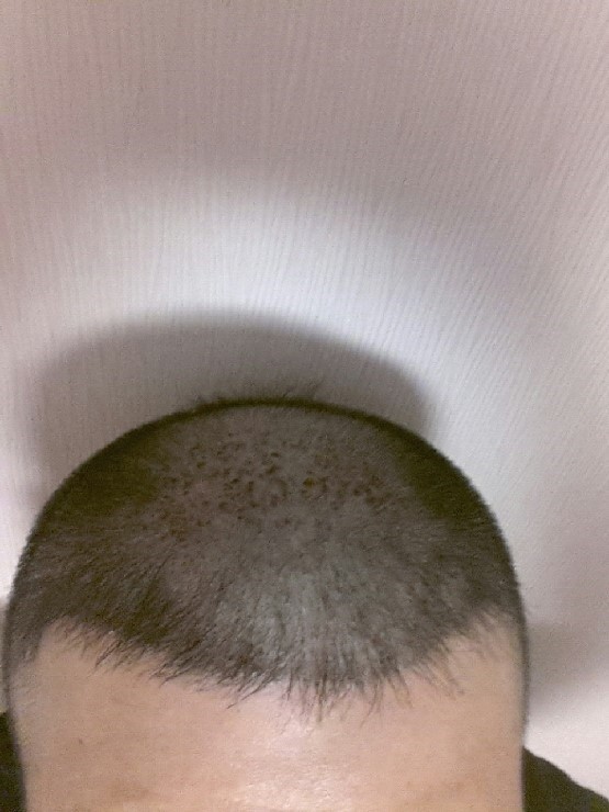 992923147.jpg
