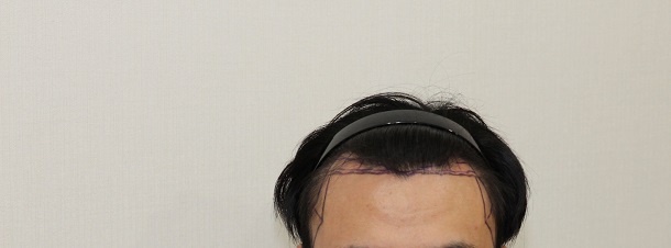 정면.jpg