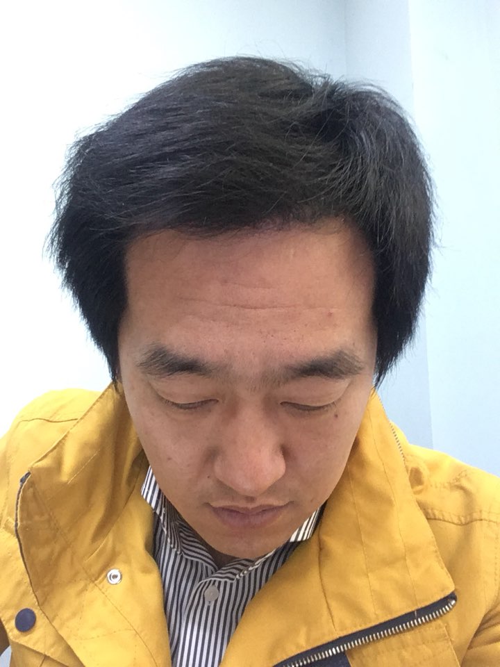 3월 19일 6개월 1일경과.jpg