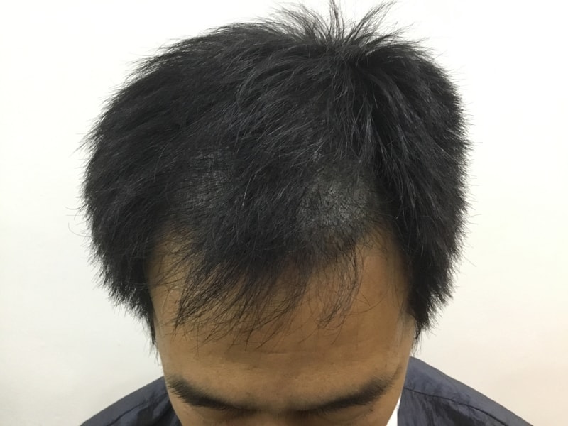 1월 18일 4개월.jpg