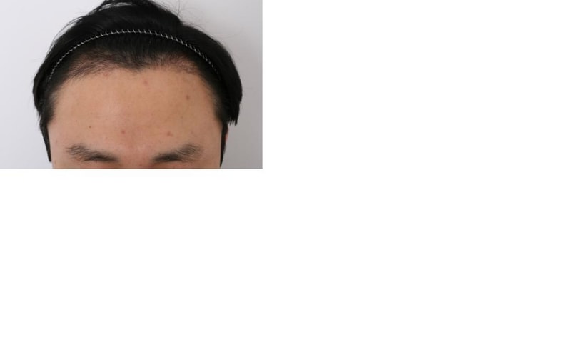4개월 경과.jpg