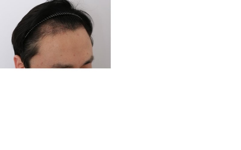 4개월 경과-1.jpg