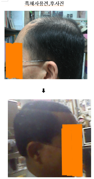 흑채사용전후사진(좌측).png