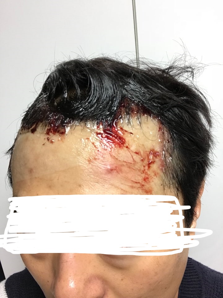 InkedKakaoTalk_20180204_131505959_LI.jpg