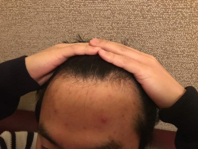 KakaoTalk_20180204_131505139.jpg