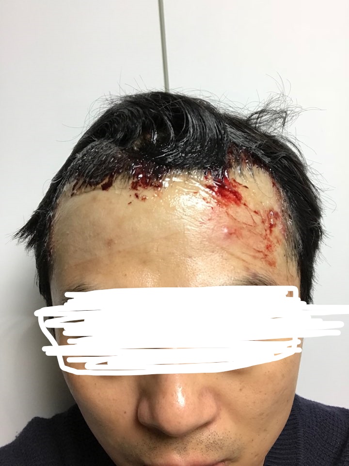 InkedKakaoTalk_20180204_131506068_LI.jpg