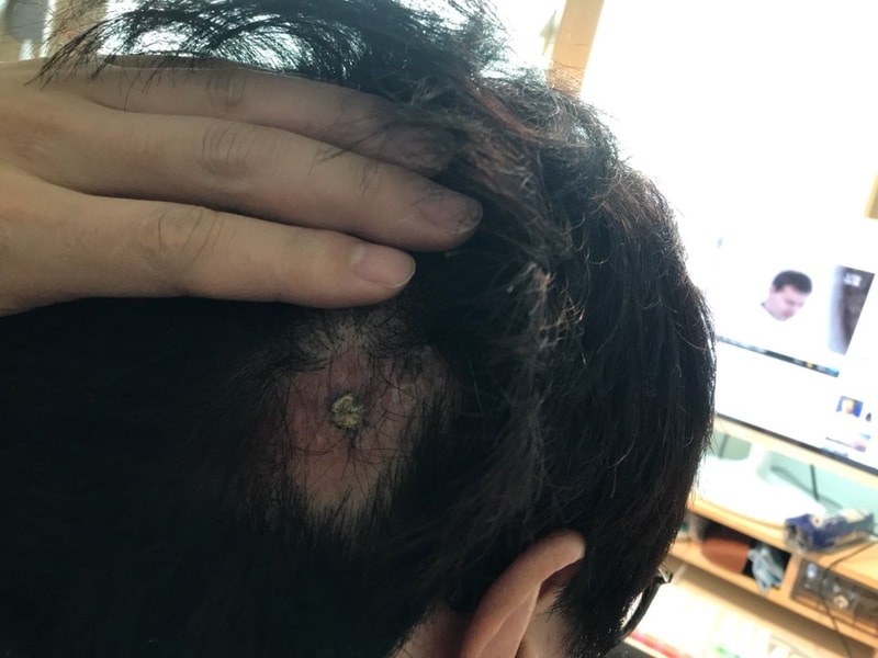 KakaoTalk_20180310_132805032.jpg
