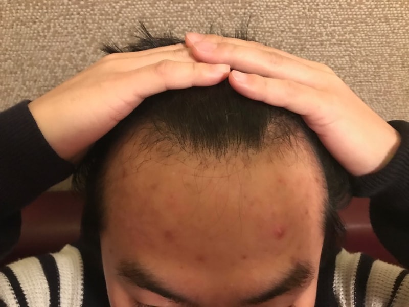 KakaoTalk_20180204_131504930.jpg