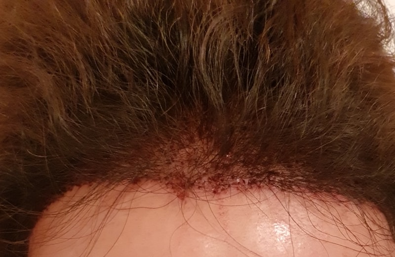 20180314_142433.jpg