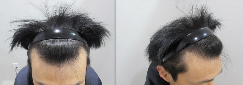 전.jpg