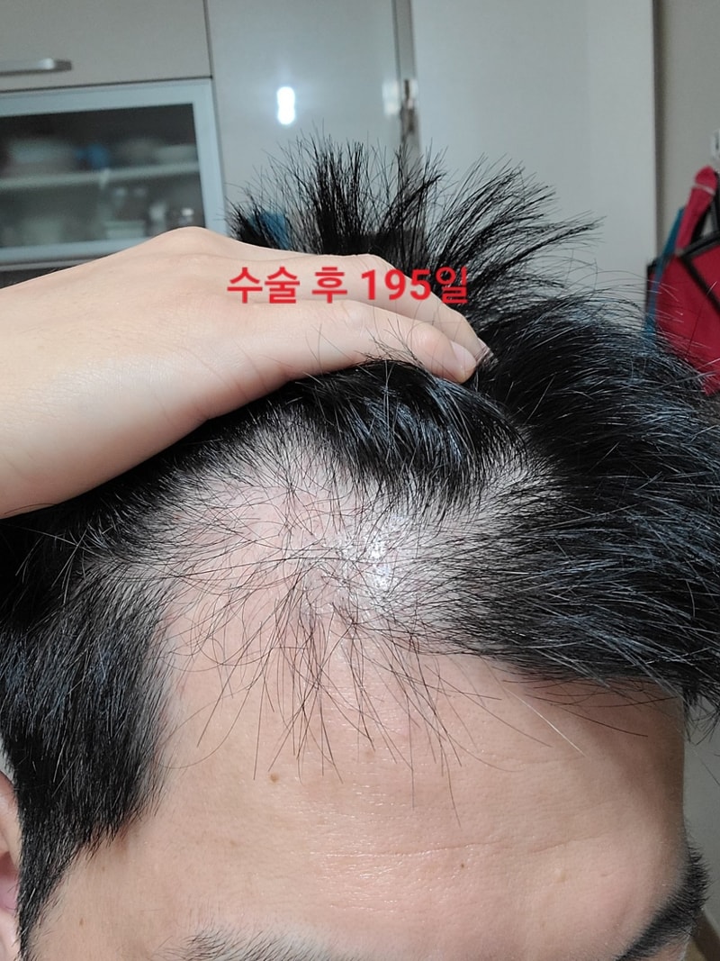 7개월 좌.jpg