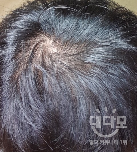 3bc22a31a896cd2820b338b3f30a58e3.jpg