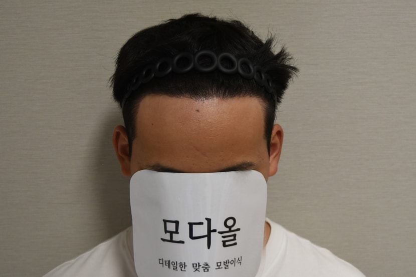 After