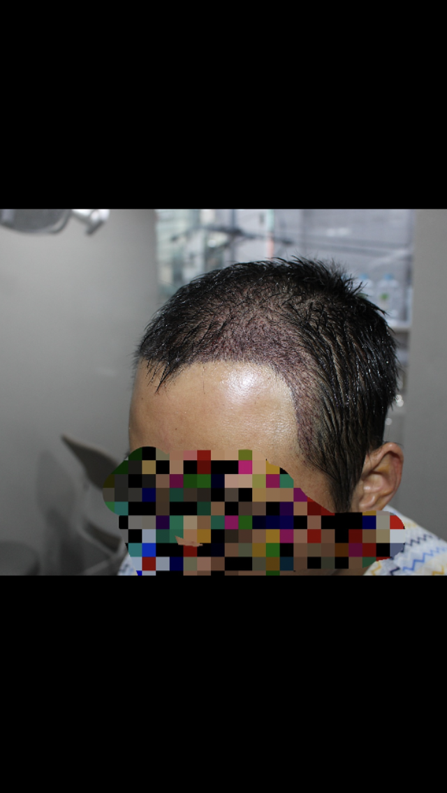 61236BD0-0987-44B8-9549-4405F40883EA.png