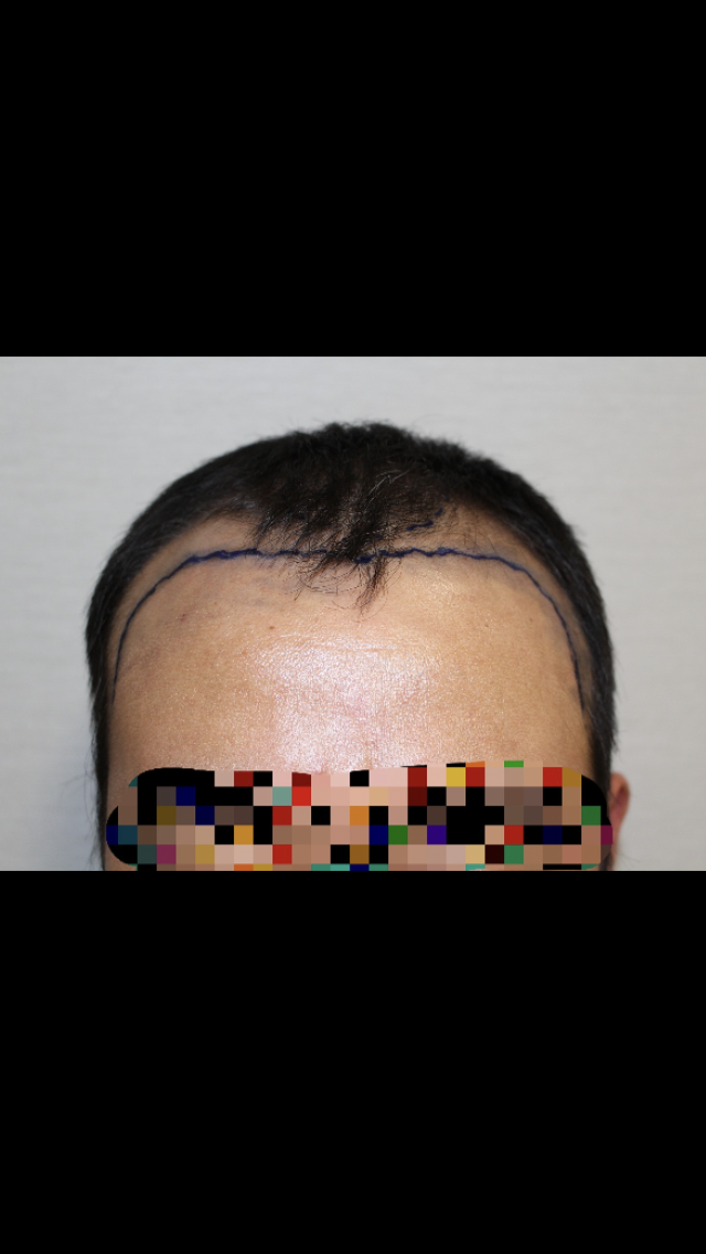 D4402215-047E-456D-9871-D4F1FACAFEB2.png