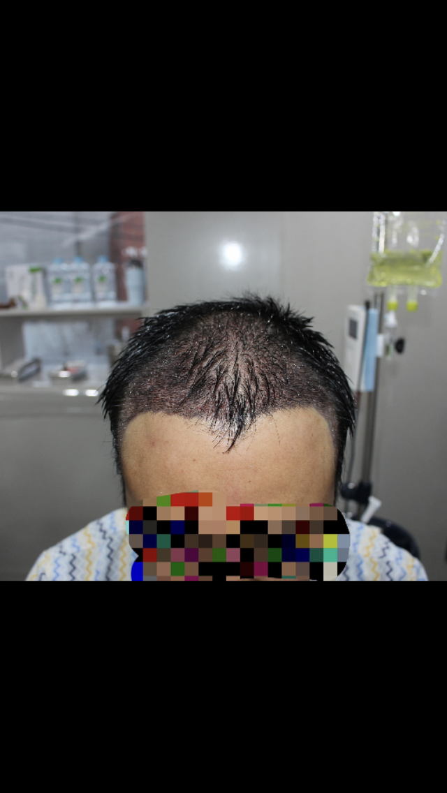 DEB949A6-7E1A-4667-847D-240A8BF8DD7B.png