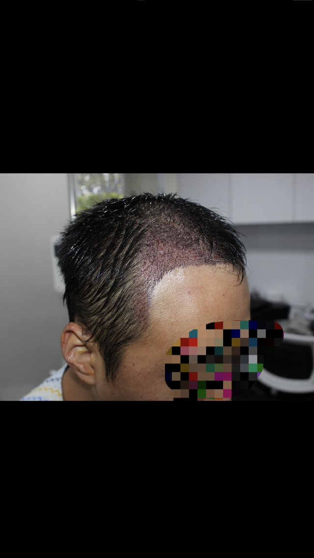 FE39FA2B-9DC7-4E44-9F9A-C93D845E7CD2.png