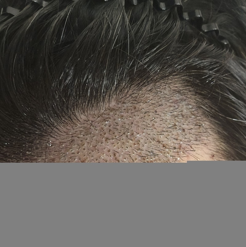 1000007778.jpg