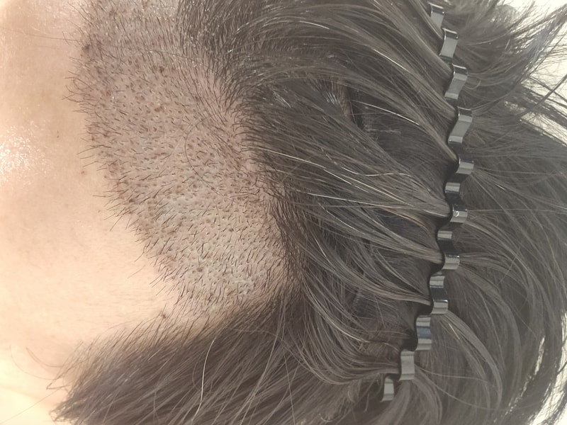 1000007781.jpg