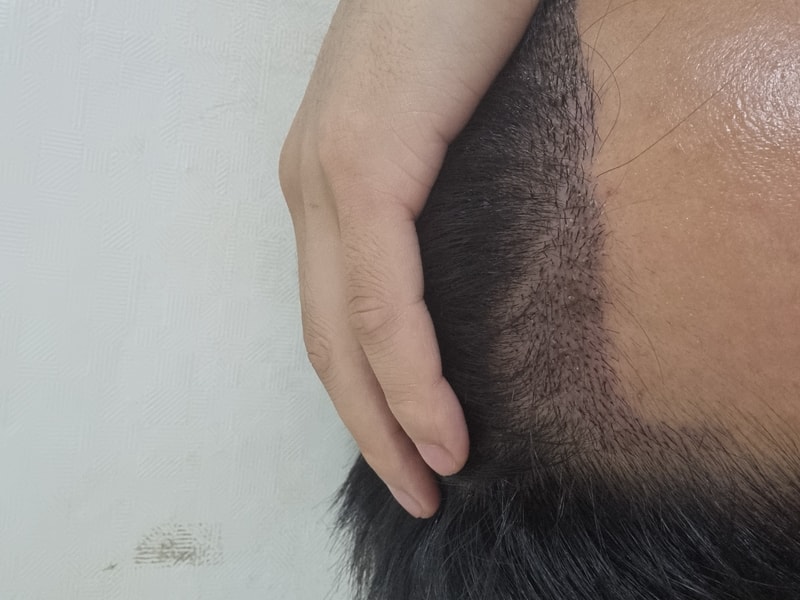 1000005647.jpg