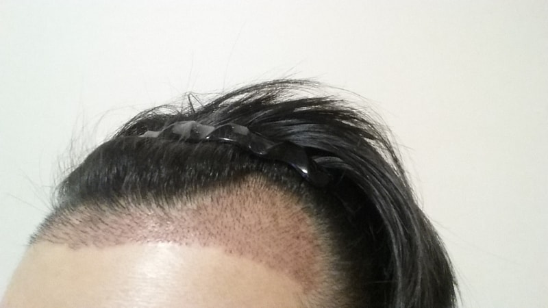 20160105_203452.jpg
