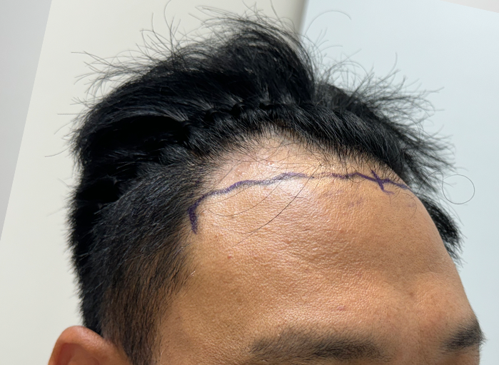 옆(전).png