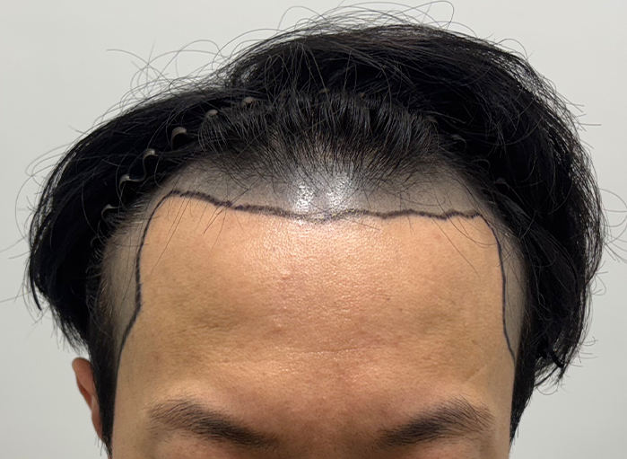 앞(전).png