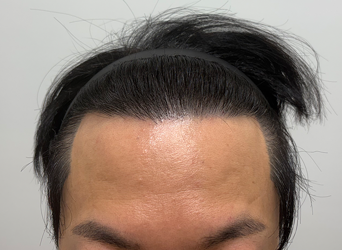 앞(후).png