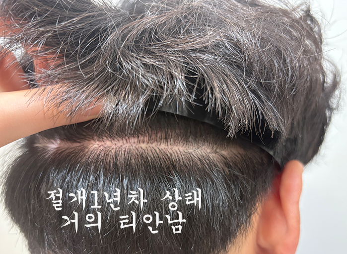 뒷머리.png