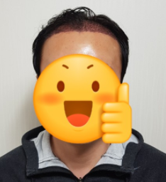 김대성 수술 1일차 1.PNG