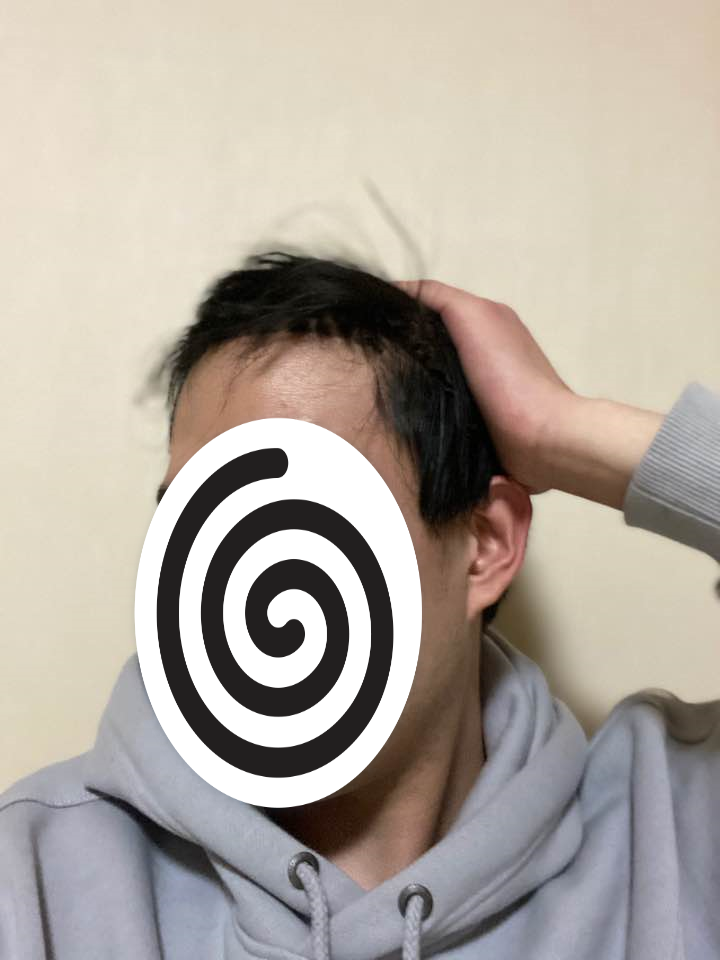 후 2.png