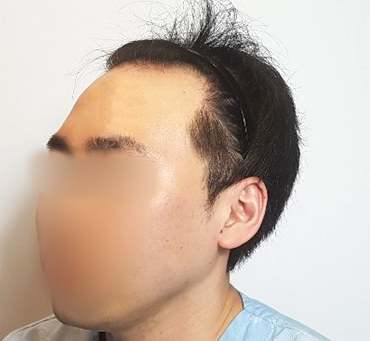 김길용 수술 전 3.PNG