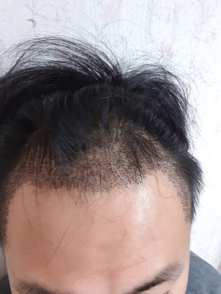 후 1.jpg