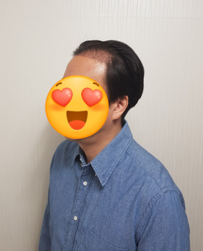 김대성 수술 14일 1.PNG