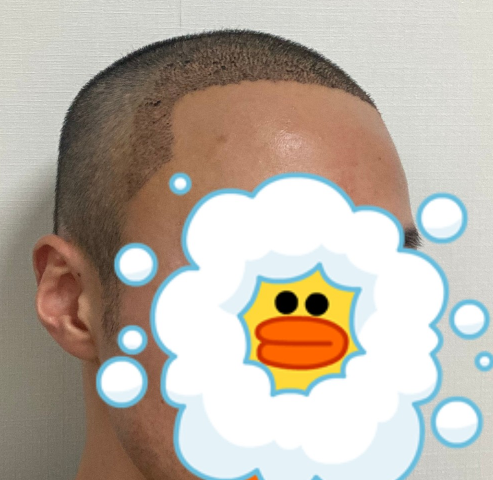 김지훈 후 2.PNG