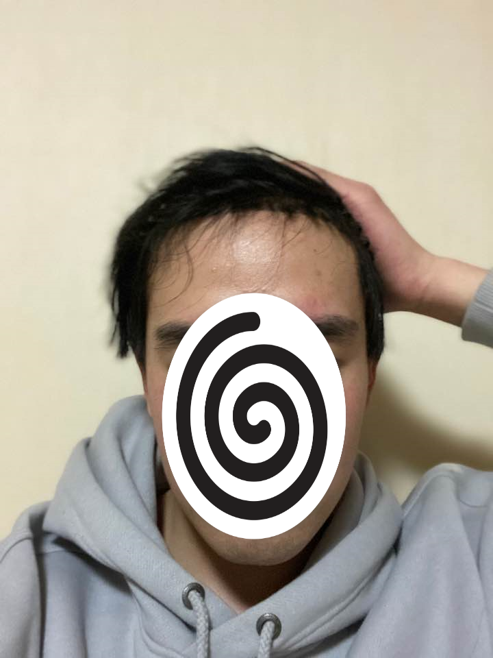 후 1.png
