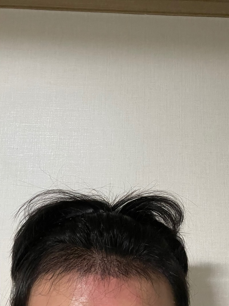 후 1.jpg