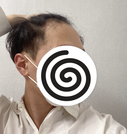 2.PNG