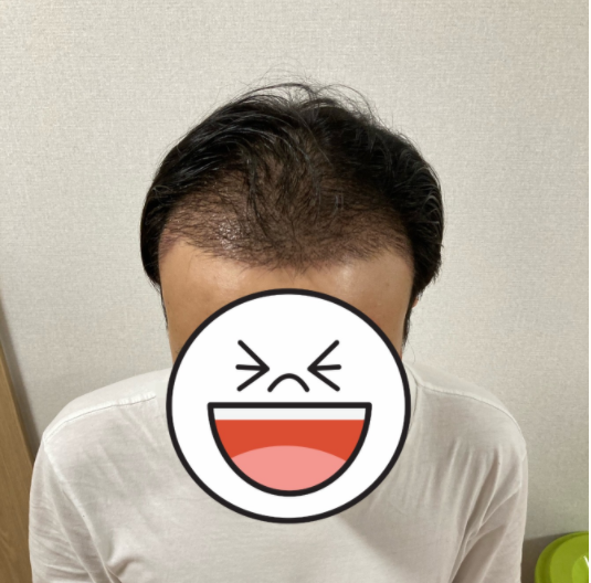 문중산14일차.PNG