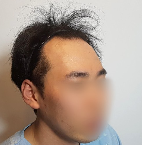 김길용 수술 전 1.PNG