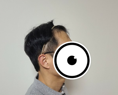 박천선 수술 전 4.PNG