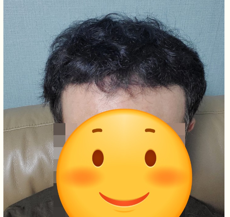 후.PNG