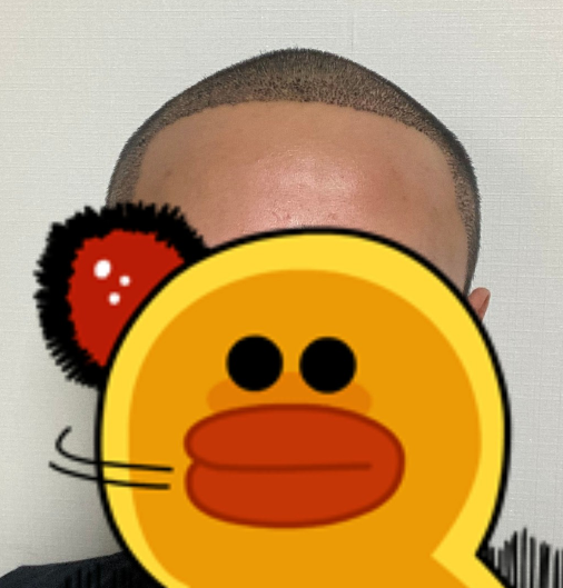 김지훈 후 3.PNG