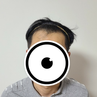 박천선 수술 전 1.PNG